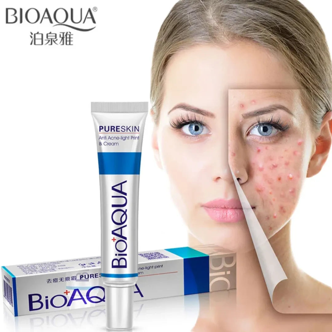 Kit Anti acne Bioaqua